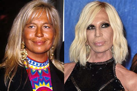 donaatella versace pentita degli interventi chirurgici|Le star prima e dopo la chirurgia: la trasformazione di Donatella .